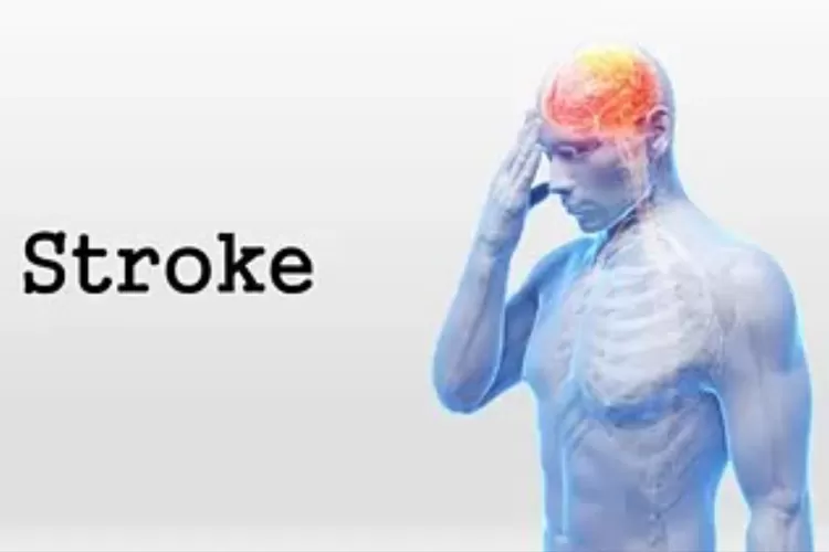 Wajib Diketahui Tentang Penyakit Stroke! Mulai dari Gejala, Penyebab ...